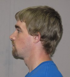 MASSET, Morgan Gerard (2)