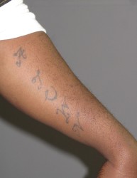TODD, Anthony Kevon4